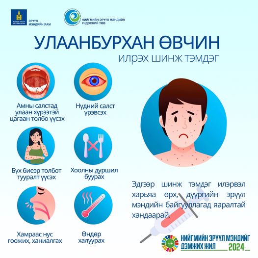 Улаанбурхан өвчний шинж тэмдэг