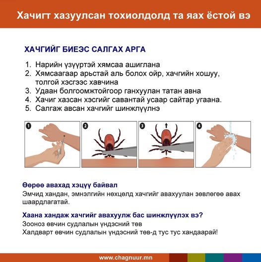 ХАЧИГТ ХАЗУУЛСАН ТОХИОЛДОЛД ЯАХ ВЭ?