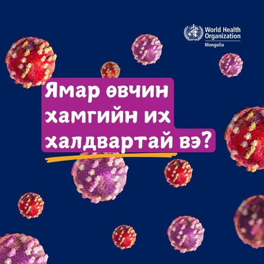 ЯМАР ӨВЧИН ХАМГИЙН ИХ ХАЛДВАРТАЙ ВЭ?