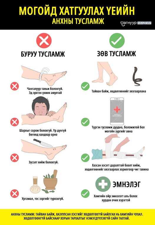 Могойд хатгуулсан үеийн анхны тусламж Могойд хатгуулсан үеийн анхны тусламж